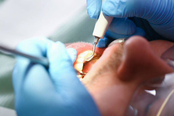 Best Weekend Emergency Dentist in Williston, ND