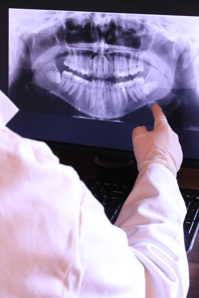 Best Emergency Root Canal Treatment in Williston, ND