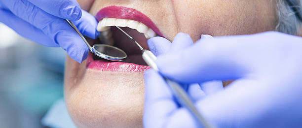 Best Emergency Tooth Extraction in Williston, ND